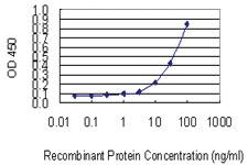 Anti-ACP2 Mouse Monoclonal Antibody [clone: M1-4A12]