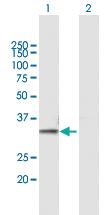 Anti-PSMB7 Mouse Polyclonal Antibody