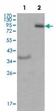 Anti-EPHA4 Mouse Monoclonal Antibody [clone: 6C1B6]