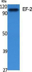 Anti-EEF2 Rabbit Polyclonal Antibody