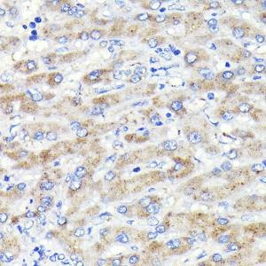 Immunohistochemistry analysis of paraffin-embedded human liver using Anti-GBA Antibody [ARC0500] (A309031) at a dilution of 1:100 (40X lens). Perform microwave antigen retrieval with 10 mM PBS buffer pH 7.2 before commencing with IHC staining protocol