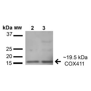 Western blot analysis of human HeLa and HEK293T cel