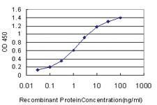 Anti-HOXA11 Mouse Monoclonal Antibody [clone: 8B8]