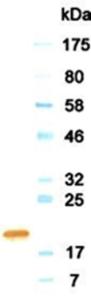 Western blotting result