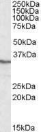 Anti-PPP4C antibody