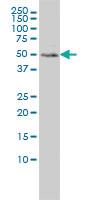 Anti-MEIS2 Mouse Monoclonal Antibody [clone: 1H4]