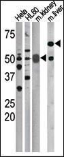 Anti-CDC25A Rabbit Polyclonal Antibody