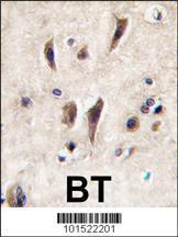 Anti-TIE1 Rabbit Polyclonal Antibody (Biotin)