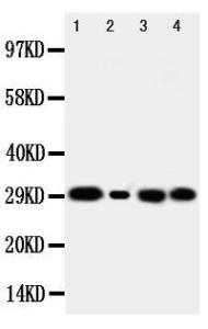 Anti-Carbonic Anhydrase I Rabbit Polyclonal Antibody