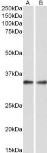 Anti-PPP4C antibody