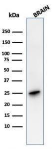 Western blot analysis of human brain tissue lysate using Anti-PGP9.5 Antibody [rUCHL1/4557]