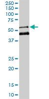 Anti-MEIS2 Mouse Monoclonal Antibody [clone: 1H4]