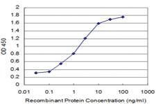 Anti-KLF1 Mouse Monoclonal Antibody [clone: 5G12]