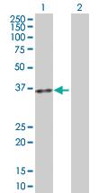 Anti-ACP5 Rabbit Polyclonal Antibody