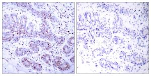 Antibody anti-STAT4 100 µg