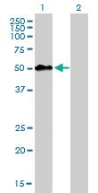 Anti-MEIS2 Mouse Monoclonal Antibody [clone: 1H4]