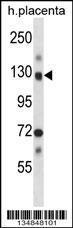 Anti-NEK9 Rabbit Polyclonal Antibody (AP (Alkaline Phosphatase))