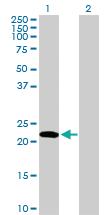 Anti-EDN1 Rabbit Polyclonal Antibody