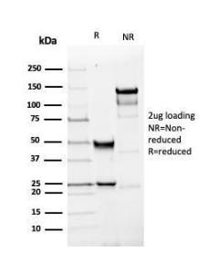 SDS-PAGE analysis of Anti-PGP9.5 Antibody [rUCHL1/4557] under non-reduced and reduced conditions; showing intact IgG and intact heavy and light chains, respectively. SDS-PAGE analysis confirms the integrity and purity of the antibody