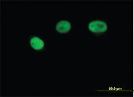 Anti-PSMB7 Mouse Polyclonal Antibody