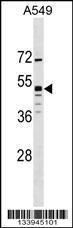 Anti-GPR83 Rabbit Polyclonal Antibody (AP (Alkaline Phosphatase))