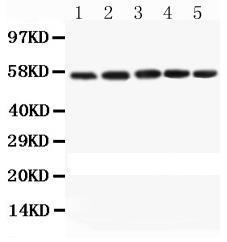 Anti-CASP8 Rabbit Polyclonal Antibody