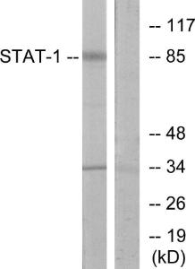 Western blot analysis of lysates from COLO205 cells using Anti-STAT1 Antibody. The right hand lane represents a negative control, where the antibody is blocked by the immunising peptide