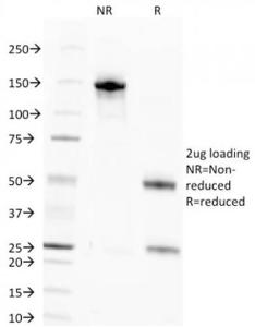 SDS-PAGE analysis of Anti-Nuclear Antigen Antibody [NM106] under non-reduced and reduced conditions; showing intact IgG and intact heavy and light chains, respectively. SDS-PAGE analysis confirms the integrity and purity of the antibody.