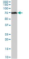 Anti-ACSL5 Goat Polyclonal Antibody