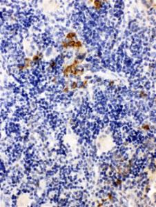 Anti-Leupaxin Rabbit Antibody