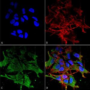 Immunocytochemistry/Immunofluorescence analysis of human neuroblastoma cell line (SK-N-BE, fixed in 4% formaldehyde for 15 min at room temperature, using Anti-SHANK2 Antibody [N23b/49] (A304967), at 1:100 for 60 minutes at room temperatur