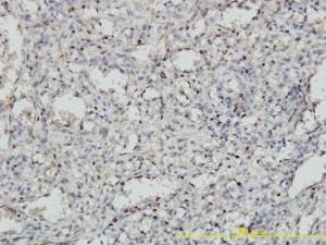 Anti-MEIS2 Mouse Monoclonal Antibody [clone: 1H4]