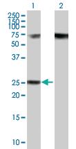 Anti-RPP40 Mouse Polyclonal Antibody