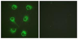 Immunofluorescence analysis of HUVEC cells using Anti-CrkL Antibody. The right hand panel represents a negative control, where the antibody was pre-incubated with the immunising peptide.