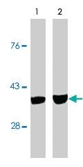 Anti-CASP7 Mouse Monoclonal Antibody [clone: MCH3-5]