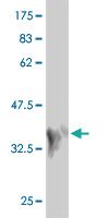 Anti-MAP2K7 Mouse Monoclonal Antibody [clone: 4E8]