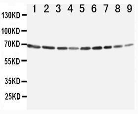 Anti-Annexin VI Rabbit Polyclonal Antibody