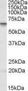 Antibody anti-STK39 100 µg