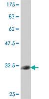 Anti-CD3D Mouse Polyclonal Antibody