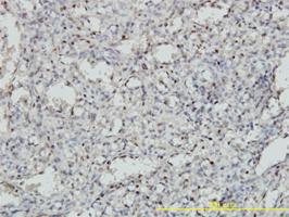 Anti-MEIS2 Mouse Monoclonal Antibody [clone: 1H4]