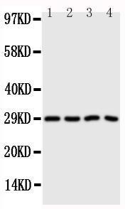 Anti-Carbonic Anhydrase III Rabbit Polyclonal Antibody