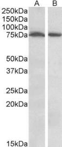 Antibody anti-STK39 100 µg