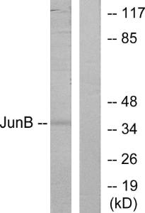 Western blot analysis of lysates from HeLa cells using Anti-JunB Antibody. The right hand lane represents a negative control, where the antibody is blocked by the immunising peptide