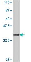 Anti-ING3 Mouse Polyclonal Antibody