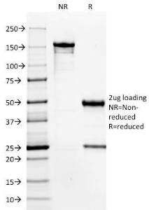 SDS-PAGE analysis of Anti-HPV16 Antibody [HPV16/1296] under non-reduced and reduced conditions; showing intact IgG and intact heavy and light chains, respectively. SDS-PAGE analysis confirms the integrity and purity of the Antibody