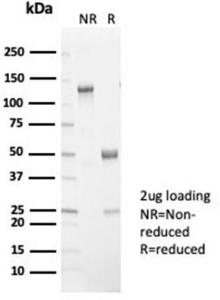 SDS-PAGE analysis of Anti-L-PLUNC Antibody [LPLUNC1/7059R] under non-reduced and reduced conditions; showing intact IgG and intact heavy and light chains, respectively. SDS-PAGE analysis confirms the integrity and purity of the antibody