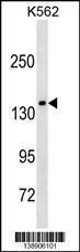 Anti-MLLT2 Rabbit Polyclonal Antibody (Biotin)