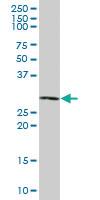 Anti-RPP40 Mouse Polyclonal Antibody