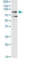 Anti-DMD Antibody Pair