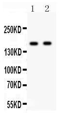 Anti-GRIN2A Rabbit Polyclonal Antibody